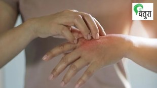 causes of allergies marathi news