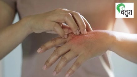 causes of allergies marathi news