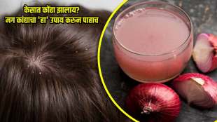 diy monsoon haircare onion juice to get rid of dandraff in marathi