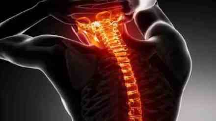 Successful Spinal Surgery in pune, D Wave Technology, Removes Tumor Without Complications, Spinal Surgery in Pune Using D Wave Technology, 38 year old woman spinal Surgery D Wave Technology, pune news,