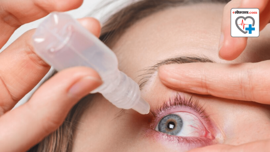 Five common eye infections you should be aware of this monsoon season Five common eye infections you should be aware of this monsoon season