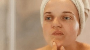 7 things for oily skin