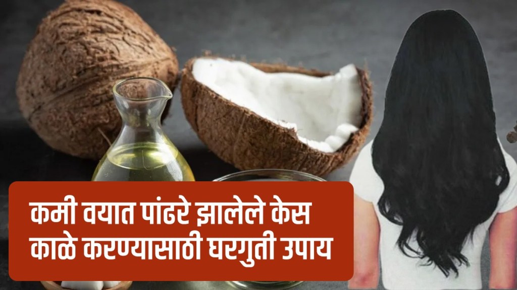 Home Remedies for White Hair Home Remedies for White Hair