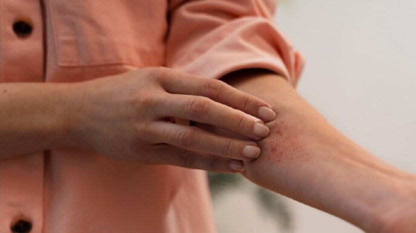 Fungal Infection In Monsoon