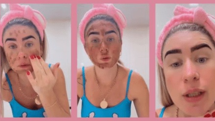 Brazilian influencer uses poop face mask in skincare routine Brazilian influencer uses poop face mask in skincare routine