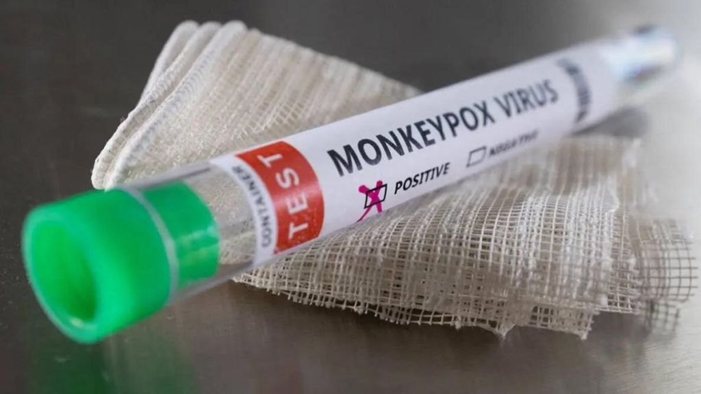 Despite more students from Africa states health department is awaiting the Centres nod about Monkeypox