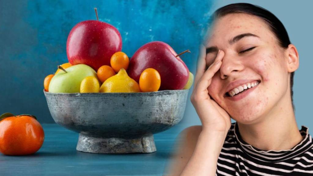 apples good for acne apples good for acne