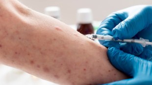 Second Mpox case reported in Kerala as man who returned from the UAE tests positive google trends