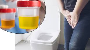 health Painful urination