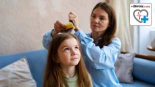 Expert tips to get rid of head lice