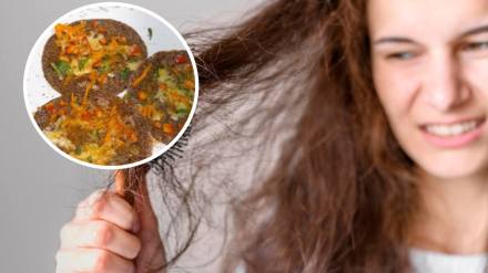 Dosa For Healthy Hair? This Dosa-Chutney Combo Will Nourish Your Hair From Within