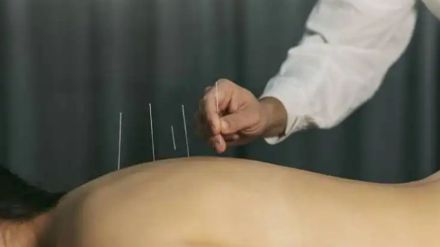 admission process for acupuncture course till December 20 admission process for acupuncture course till December 20