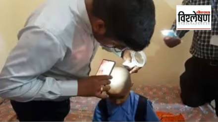 What exactly is the case of hair loss in Buldhana district What exactly is the case of hair loss in Buldhana district