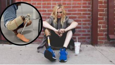 narayan seva sanstha has provided 40 000 artificial limbs and plans to expand in maharashtra narayan seva sanstha has provided 40 000 artificial limbs and plans to expand in maharashtra