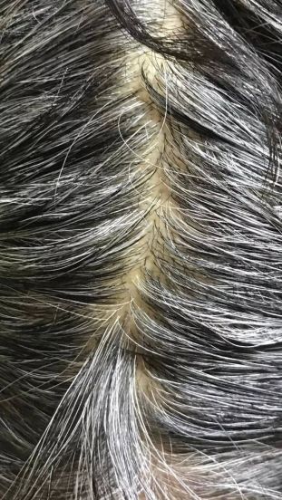 Boost Hair Growth & Stop Hair Fall Naturally with These 10 Benefits of Curry Leaves