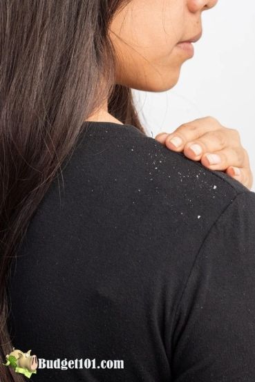 Boost Hair Growth & Stop Hair Fall Naturally with These 10 Benefits of Curry Leaves