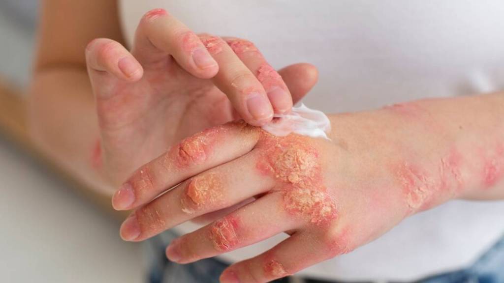 Summer Skin Tips for Kids