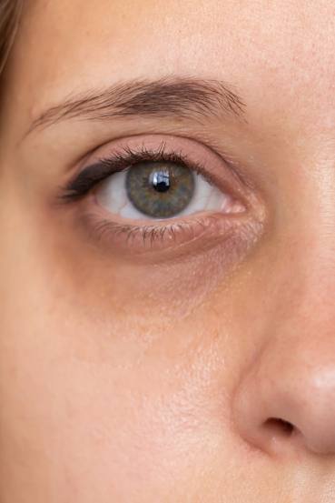 9 Powerful Aloe Vera Remedies for Naturally Glowing and Clear Skin at Home