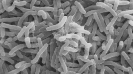 Cholera outbreak in Akola