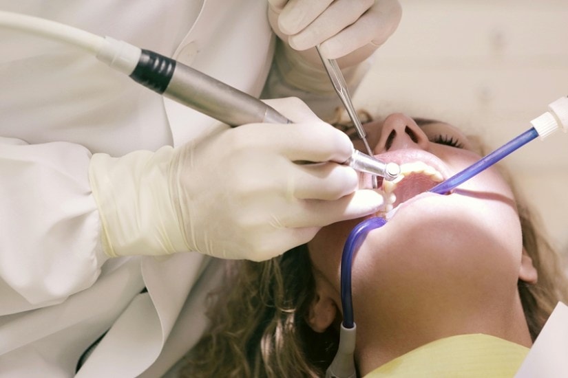 Causes of black teeth