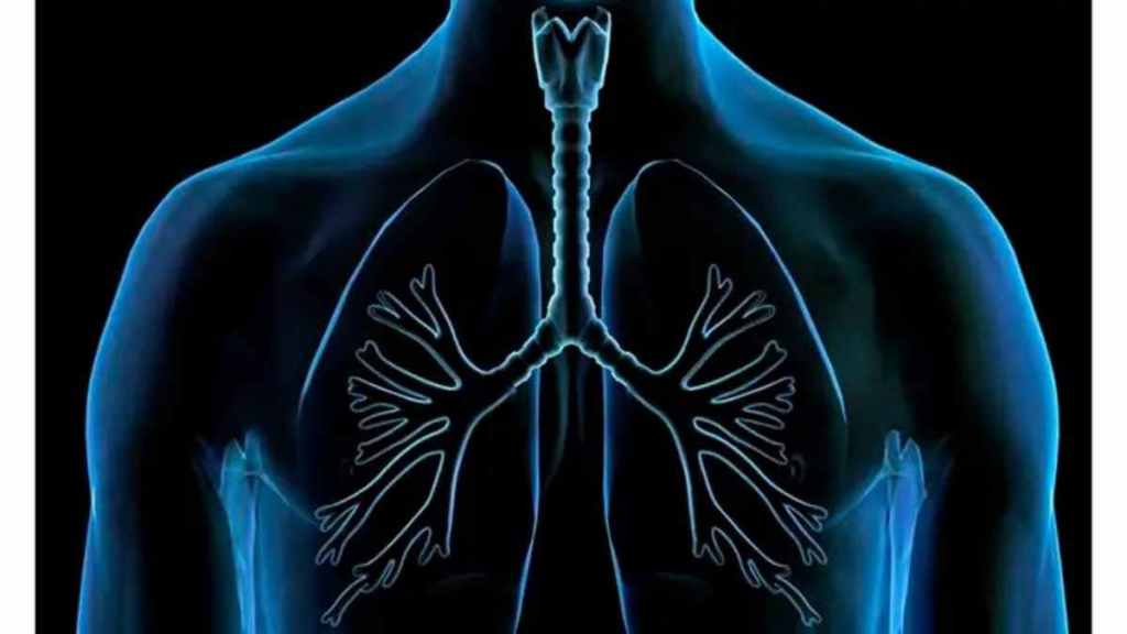Surgeons remove successfully nail from man lung