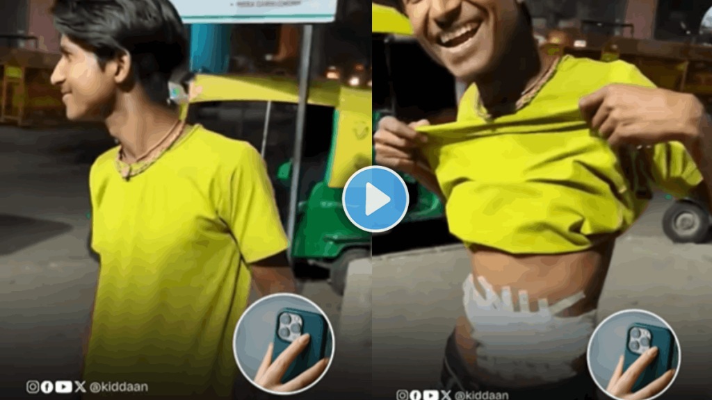 youn man sold his kidney to impress girlfriend youn man sold his kidney to impress girlfriend