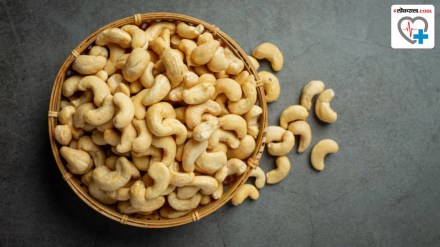 Do Cashews Spike Blood Sugar Level : Do Cashews Spike Blood Sugar Level :