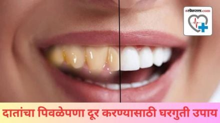 Natural Ways To Clean Teeth