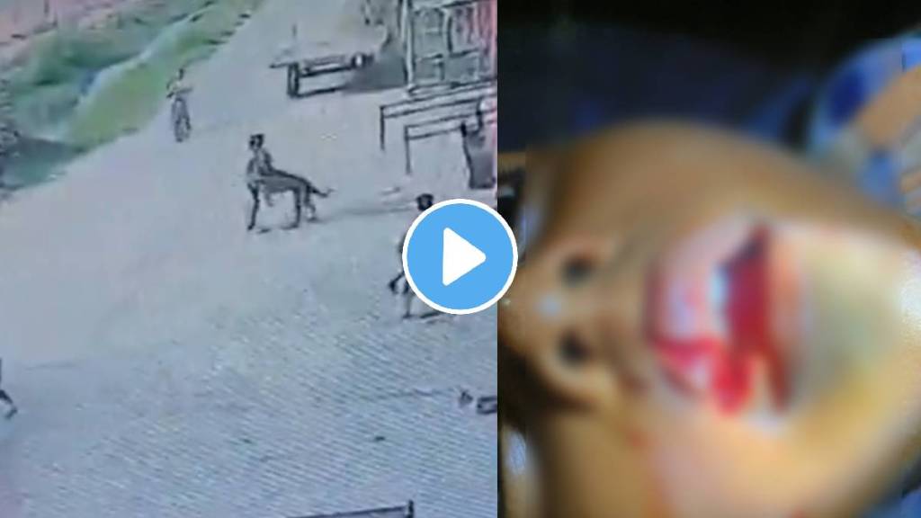Shocking video Rabies Infected Stray Dog Attacks 8-Year-Old Boy, Bites Off His Lips In UP's Meerut Shocking video Rabies Infected Stray Dog Attacks 8-Year-Old Boy, Bites Off His Lips In UP's Meerut