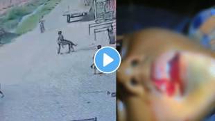 Shocking video Rabies Infected Stray Dog Attacks 8-Year-Old Boy, Bites Off His Lips In UP's Meerut