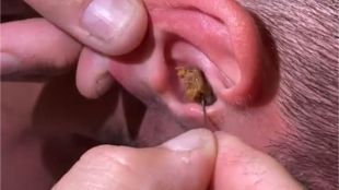 ear cleaning tips