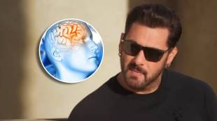Brain Aneurysm, AV Malformation, AVM, , Salman Khan