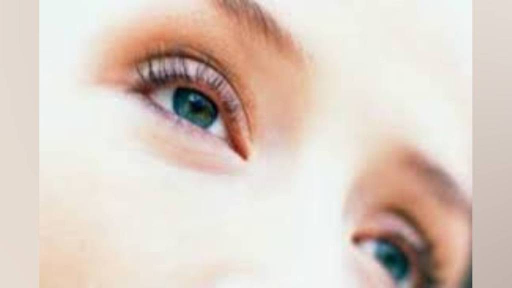 lasik eye surgery