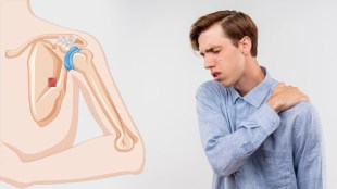 Best foods to reduce uric acid