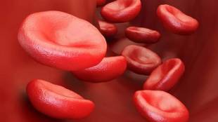 World Sickle Cell Day 19th june