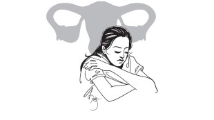 infertility issue in women