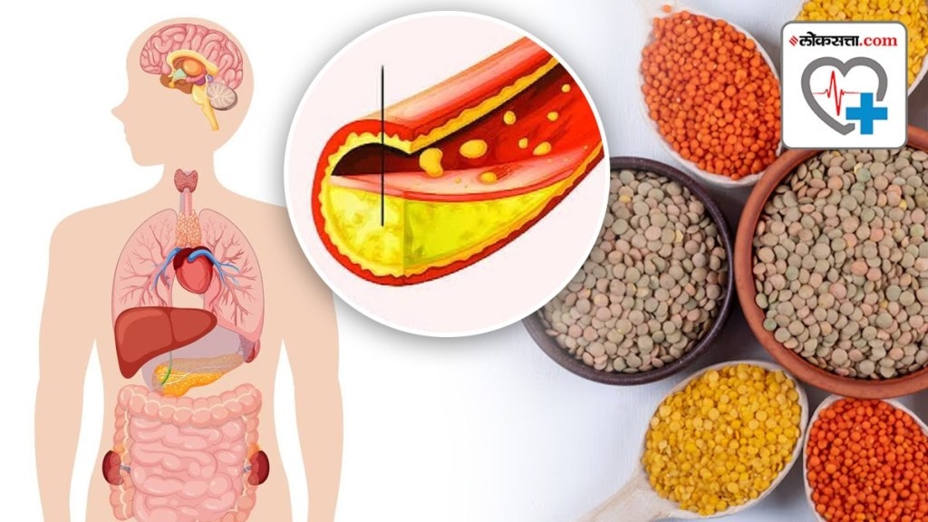 signs of high cholesterol