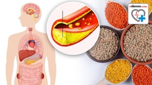 signs of high cholesterol