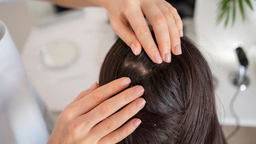 anti-fungal shampoo, black hair care, hair care