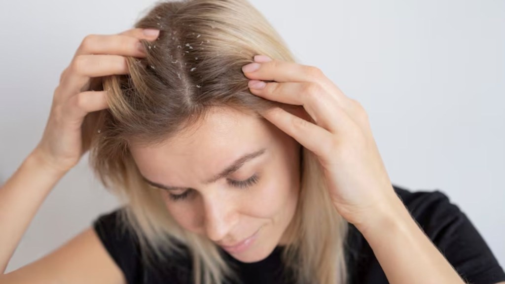 hair care in rain, hair care tips, monsoon season