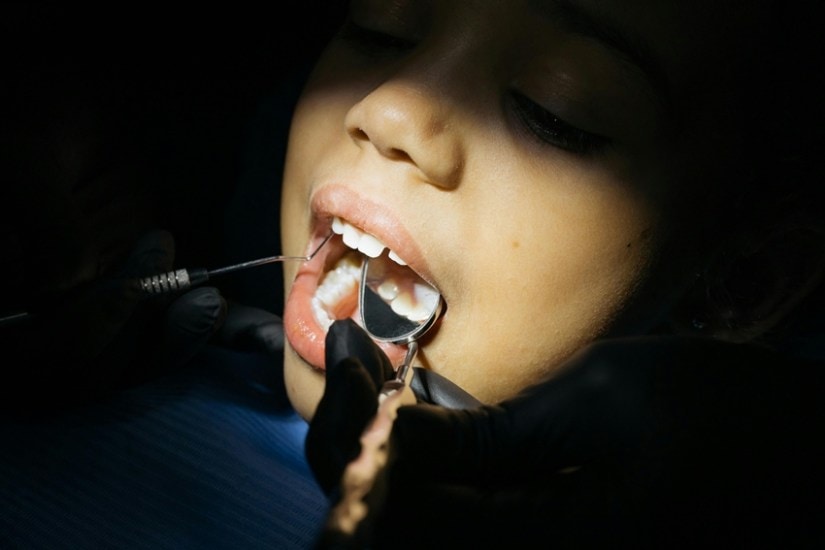 Say Goodbye to Tooth Decay Try These Powerful Home Remedies Today
