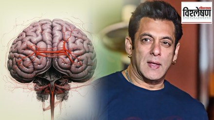 salman khan brain diseases