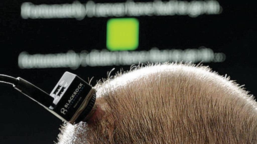 microchip implant research news in marathi