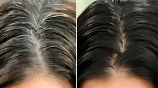 white hair solution remedy to turn white hair black Mustard oil ayurveda