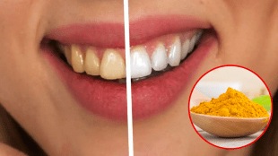 yellow stains on teeth how to remove yellowness from teeth home remedies for yellow teeth