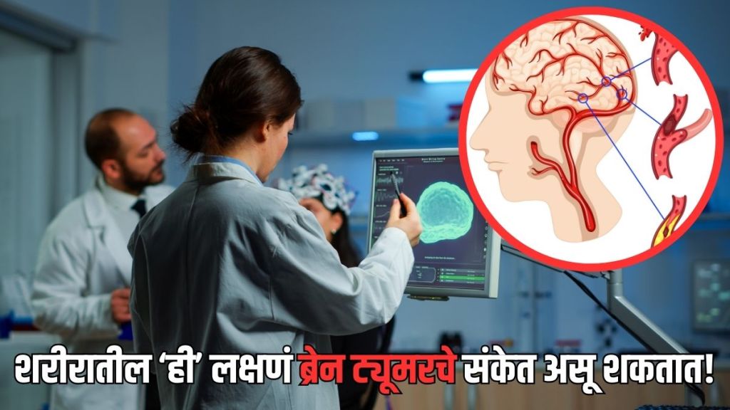 Brain Tumor Symptoms