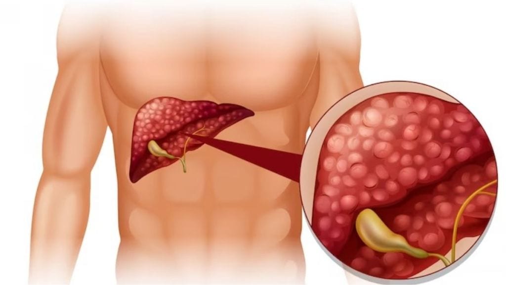 Benefits of Coriander leaves for Kidneys