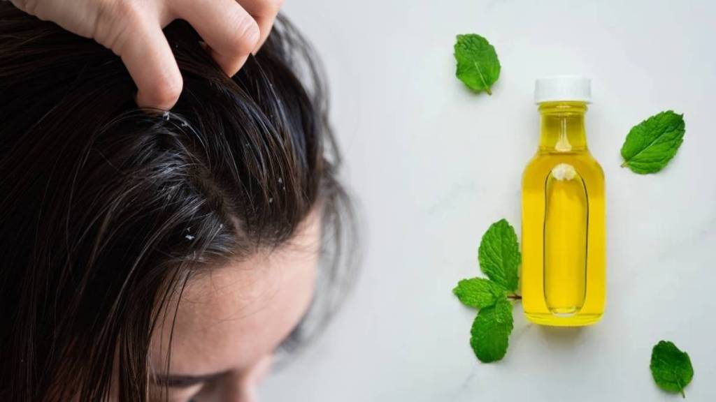 Dandruff Remedies For Monsoon in marathi
