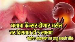 Throat Cancer: घशाचा कॅन्सर होणार असेल तर दिसतात ही ५ लक्षणं; साधारण वाटणारी पण जीव घेऊ शकतात, वेळीच ओळखलं तर वाचू शकतो जीव
