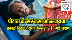 सकाळी दिसतं पोटाच्या कॅन्सरचं “हे” मोठं लक्षण; अजिबात दुर्लक्ष न करता वेळेत जीव कसा वाचवाल? जाणून घ्या